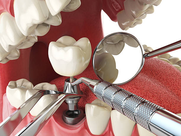 Best Pediatric Emergency Dentist in Ankeny, IA